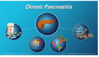 chronic pancreatitis-1